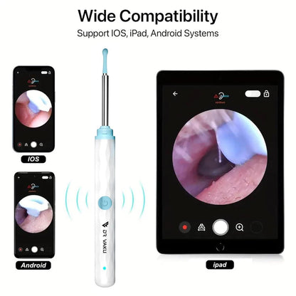 Smart Visual Ear Wax Cleaner 0jyzfu-7t