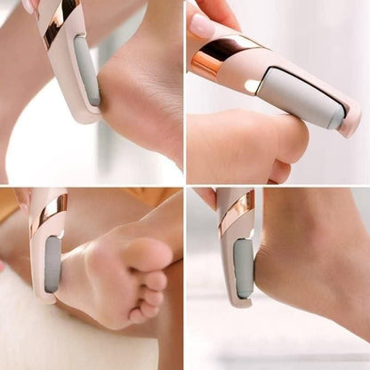 Electronic Cordless Pedicure Callus Dead Skin Remover Polishing Tool 0jyzfu-7t