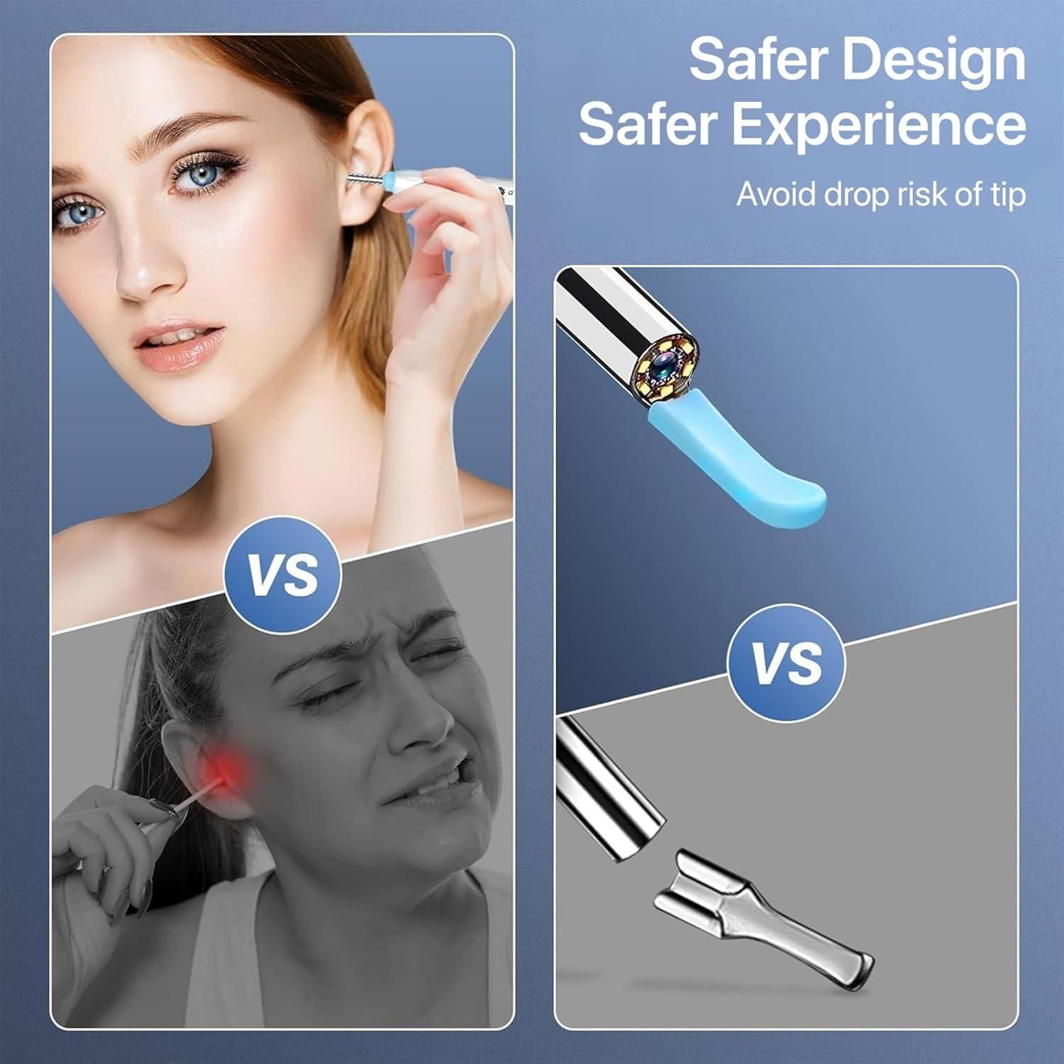 Smart Visual Ear Wax Cleaner 0jyzfu-7t